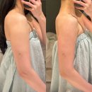 포텐핏 | 동탄 신부관리 체험, 승모근과 팔뚝살까지 선에스테스파 동탐역점에서 관리받고 온 후기!