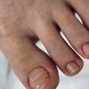 레푸스네일디바 | 건대 군자역 내성발톱 꾸준히 믿고 찾는 네일디바&레푸스건대점