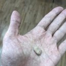 오티콘보청기 신촌센터 해피히어링 이미지