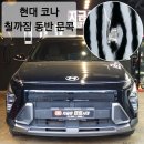 지금은덴트시대