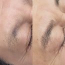 천안 반영구 헤어스트록 5년 고민 끝에 결정한 뷰티문 후기