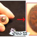 코리아의안센터 티스토리