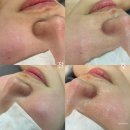 마온 | [양산 중부동]양산피부관리 - 마온에스테틱 방문 후기