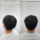 헤드샷스칼프SMP부산