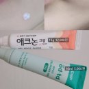 용해약국 | 애크논 크림 (약국 여드름 연고 내돈내산) 아픈 여드름 효과, 다이소 CNP 스팟카밍젤 비교