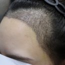 압구정모비앙의원 이미지