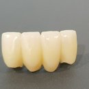 아침치과기공소 이미지