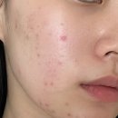 명성의원 - 완도군 약산로 383-3 | 동탄피부과에서 영통보톡스 알아보다가 받은 후기