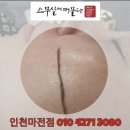 루미스킨 - 은평구 진흥로 81 | 루미스킨