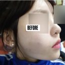 타임동안뷰티센터타임그루답터포맨 | 받고 피부가 보들보들 피부결이 달라졌어요 덕소피부관리 타임동안뷰티센터 타임에스테틱 타임그루답터포맨