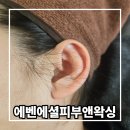 이혈요법 | 상인동 피부관리실 에벤에셜피부앤왁싱의 이혈테라피 후기