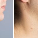 피팅의원 이미지