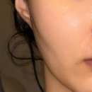 6713 | 진짜 내돈내산 메디큐브 에이지알 하이 포커스 샷 플러스 후기, 사용 후 인후통 목아픔 저만 있나요?