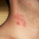 바를정한의원 이미지