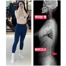 성심메디칼 | [연신내 헬스장] 미용사 회원의 재활부터 다이어트까지 후기 - 1탄