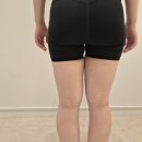 대전 멍택시 | 대전 허벅지 무한람스 당일 후기 | 붓기, 멍, 통증 솔직후기