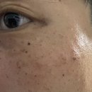 연세맑은피부과의원 이미지