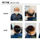 재구가발 이미지