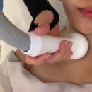 꼼꼼성형외과의원 | 대구리프팅 이중턱관리 잘하는곳 수성구 황금동 피부관리실 오하이스킨 써마웨이브 후기