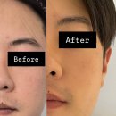 엄궁파출소 | 사상기미잡티관리추천 꼼꼼맞춤시술로 잡티없는피부 이곳피부샵 리얼후기