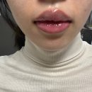 11500-17-51-23 | 다크립 입술문신 내돈내산 솔직후기(리터치 2개월 경과)+꿀팁