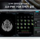 제이엘케이 이미지