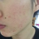 판도라바른약국 | 옐로우로즈 - 클리어스팟세럼, 스팟케어, 비상상비 스팟제품, 톡스팟, 여드름스팟, 트러블관리