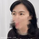 에이치(H)헤어라인