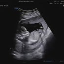 리움여성의원 이미지