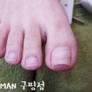 구미네일.구미구평네일.구미진평네일남자다운네일.구평네일샵.진평네일샵.인동네일샵.내성발톱.파고드는...