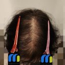 대구차여성의원 이미지