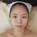 대구동성로피부관리실 e향기로운스킨케어 림프순환관리 후기