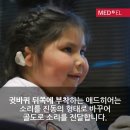 소이애드