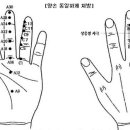 기관지 천식 서금요법 치료와 식이요법 처방 이미지