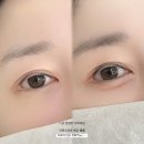 디프미