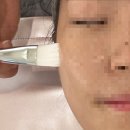 오렌지브로우 | [강서구 피부관리] 수분과 피부결 완성! 오렌지 브로우 하이푸리프팅 후기