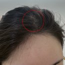 논두렁길콩서리 | 서리맥스 한 달 후기｜꾸준히 먹어본 솔직한 변화, 머리 빠짐은 조금 줄어든 것 같아요