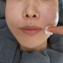 맑은인한의원 | 청담피부과 엘라비에 리투오 6cc 콜라겐부스터 후기