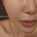 서인에스테틱 네이버블로그