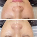포항 피부샵에서 코나피딜 세멘시트 사용 후기 (웨딩관리 전문 에스테틱 아더뷰티크 스킨왁싱)