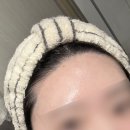 복대동 페이스왁싱 [리솜뷰티] 헤어라인+구렛나루 왁싱 후기