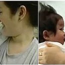 하람메디칼 이미지