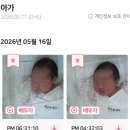 꽈배기의제왕 | 동탄제일병원 제왕절개 4~5일차 후기 (신생아실 면회, 퇴원수속, 4박 5일 비용, 조리원 이동, 6일차...