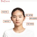 [압구정앤/AJ] 안면윤곽후기