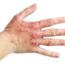 위드유한의원 이미지