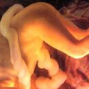 뱃속에 있는 태아들에 대한 모든 정보! 낙태휴우증 이미지