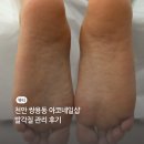 아코네일 | 쌍용동신상네일샵 아코네일(feat. 문제성발각질, 발톱케어)