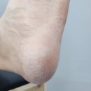 부산패디플래닝 발 각질 시원하게 벗겨주는 [라움네일] 후기