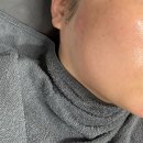 광주 첨단 피부관리 ‘예뻐지는샵’ :: 화잘먹 치트키 세라링관리 후기