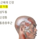 관자놀이 통증 머리 두통 심할때 원인 및 없애는법 이미지